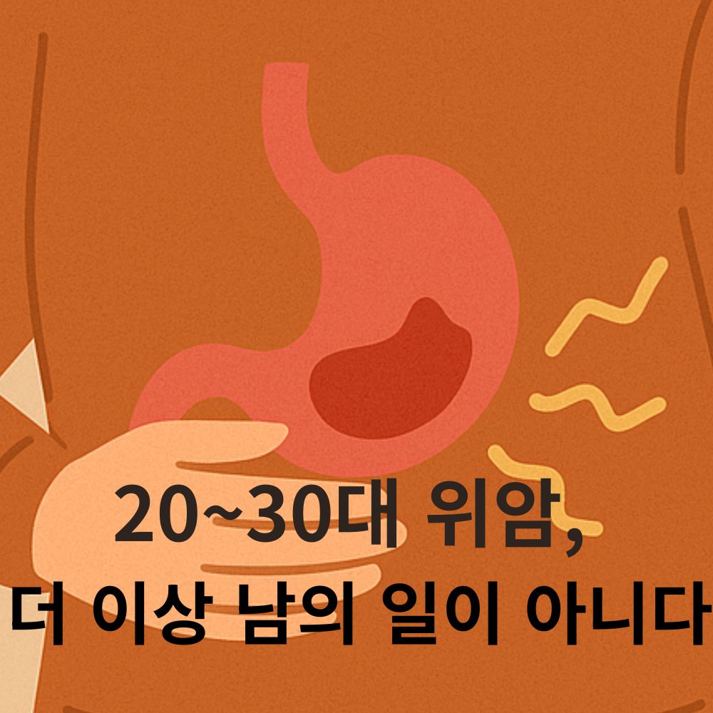 20~30대 위암, 더 이상 남의 일이 아니다